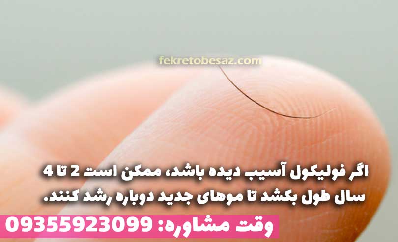 اگر درمان وسواس کندن مو پیگیری نشود، فولیکول مو آسیب می بیند